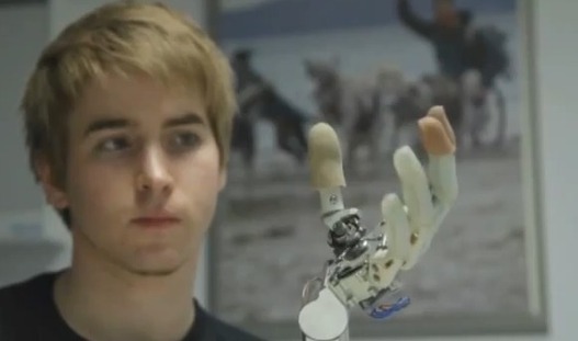 Une main bionique pilotée par la pensée